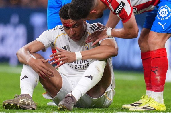 安安查配资查询 【西甲】卫星俱乐部赫罗纳帮助曼城复仇皇马? 姆巴佩被打出血仍无点球